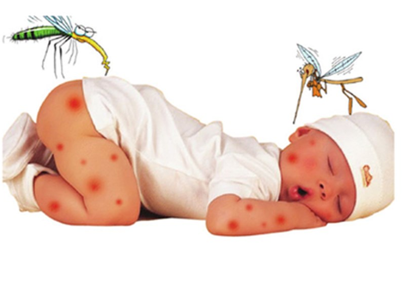 Bệnh sốt xuất huyết ở trẻ em và cách điều trị