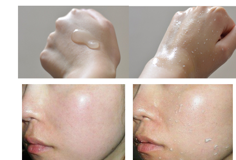 4 cách cứu hộ da mặt bị sần dành cho các cô gái