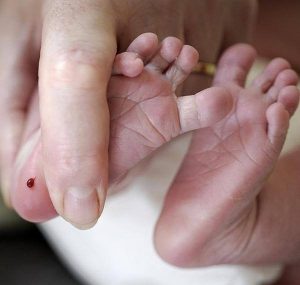 Lấy máu gót chân cho trẻ sơ sinh có quan trọng không?
